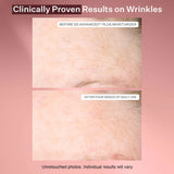StriVectin  SD Advanced™ PLUS Intensive Moisturizer for Stretchmarks and Wrinkles mini - 10 ml