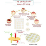 COSRX Acne Pimple Master Patch (24 patches)