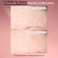 StriVectin  SD Advanced™ PLUS Intensive Moisturizer for Stretchmarks and Wrinkles mini - 10 ml